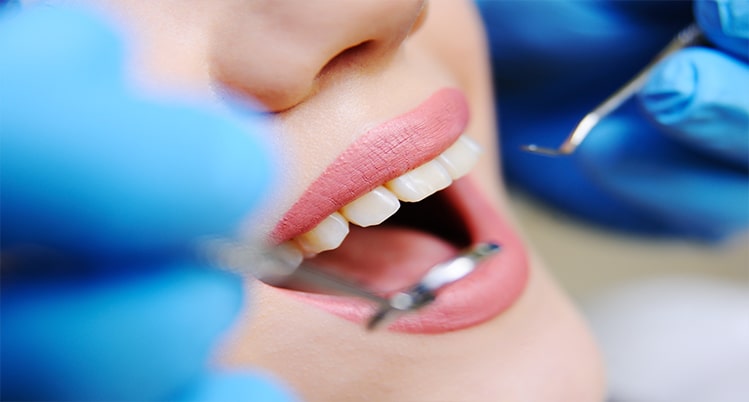 当院の予防歯科のメニュー